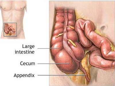 Appendix