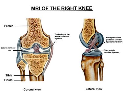 Knee