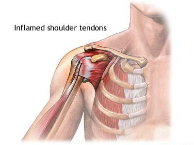 Shoulder
