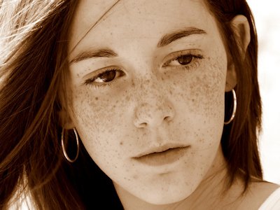 Freckle